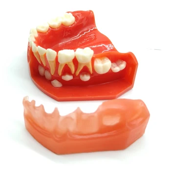Zobu Zobu Modelis Samaisa Dentition Bērnu Attīstības Modeli Vecuma 5-9 M7012