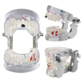 Zobu Patoloģijas Modelis Piena Zobi Pārredzamu Zobārstniecības Studiju Zobu Modelis Zobārstniecības Instrumentu